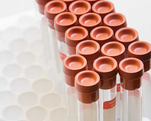 重庆代孕公司在哪里,重庆三代试管婴儿费用明细是怎样的？