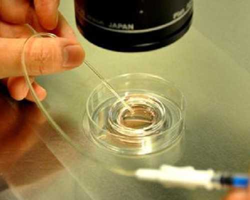 老公不知道孩子是供卵生的&国内供卵服务机构,[高龄夫妻备孕前的准备]卵巢位