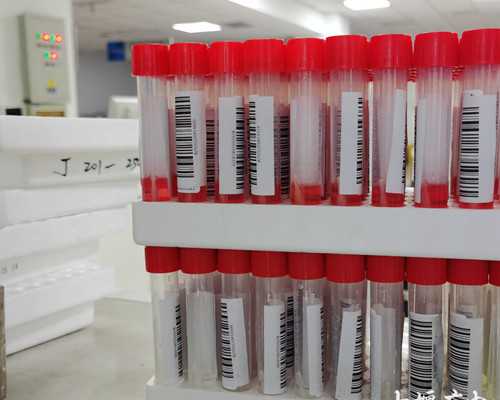 囟门闭合晚怎么办