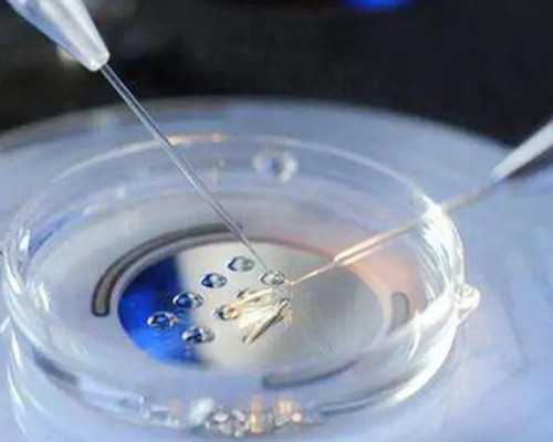 重庆市妇幼保健院生殖科哪个主管医生做试管好些？