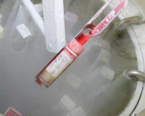 38岁试管不成功怎么办&弱精症试管要求,备孕难！如何提高怀孕的几率？