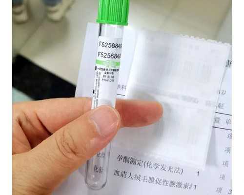 重庆渝中区公立幼儿园入园条件有哪些？要当地户籍吗？