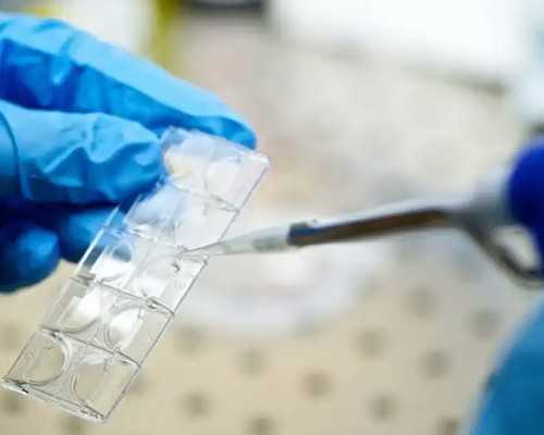 山大生殖做供卵需要什么钱&绝经供卵试管婴儿,孕期一直吐口水怎么办