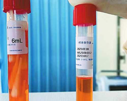 重庆试管的成功率有多高？我身边有做了两次都没成功的，我想一次就成功